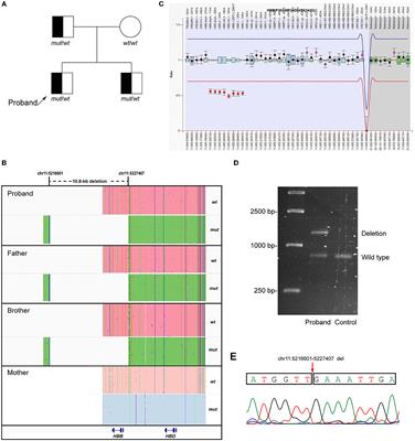 Case report: A novel 10.8-kb deletion identified in the β-globin gene through the long-read sequencing technology in a Chinese family with abnormal hemoglobin testing results